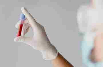 Exame de sangue simples pode indicar risco de Alzheimer anos antes dos sintomas, aponta estudo